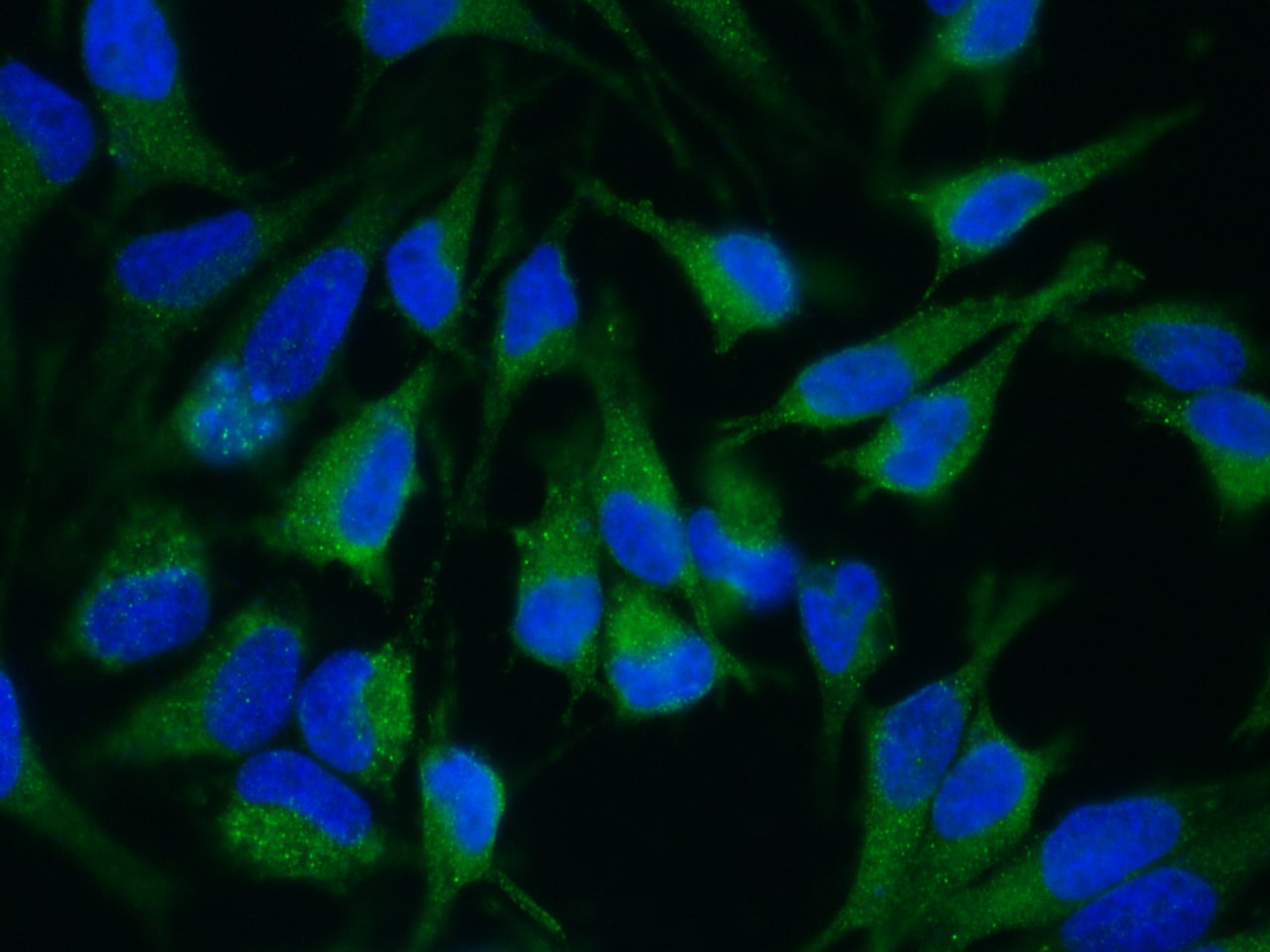 ADAM15 Antibody (007) - Azide and BSA Free