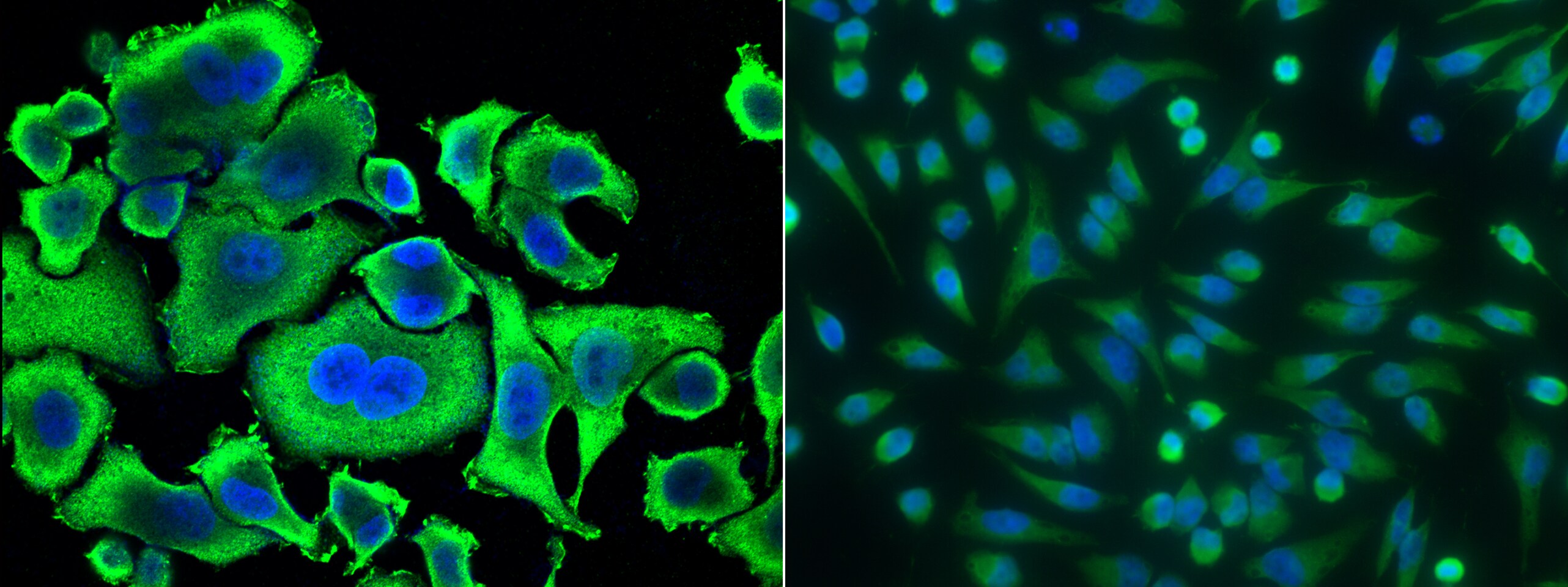 Aminoacylase/ACY1 Antibody (006) - Azide and BSA Free