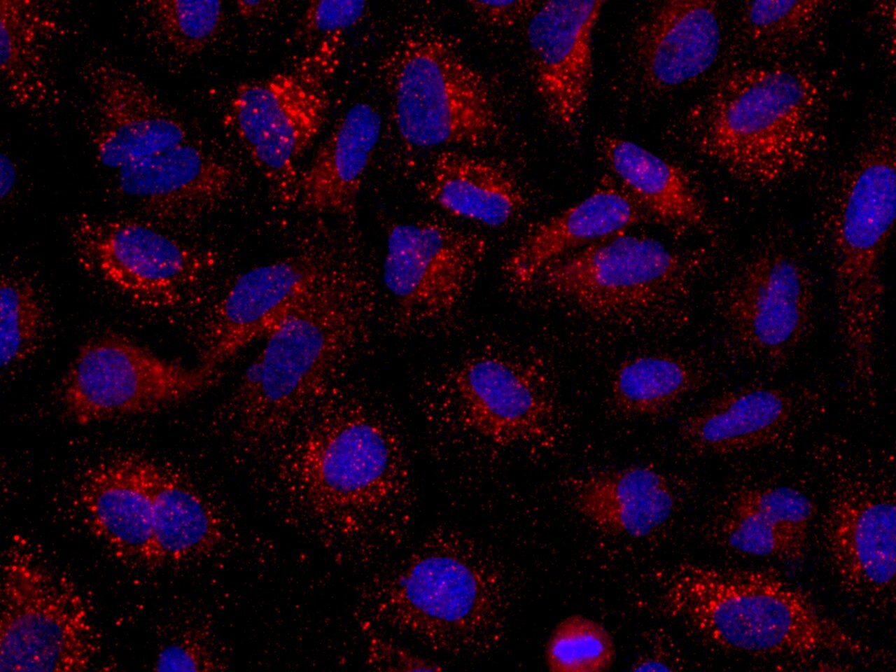 Angiopoietin-2 Antibody (117) - Azide and BSA Free