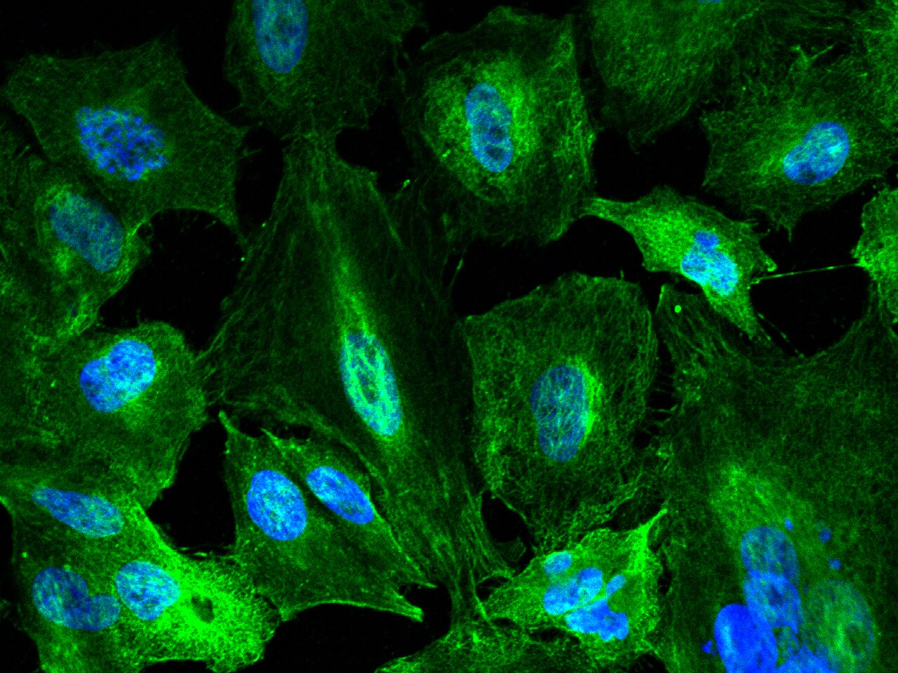 Kynureninase Antibody (062) - Azide and BSA Free