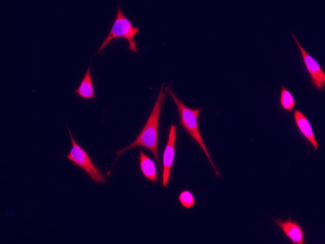 S100A7/Psoriasin Antibody (128) - Azide and BSA Free