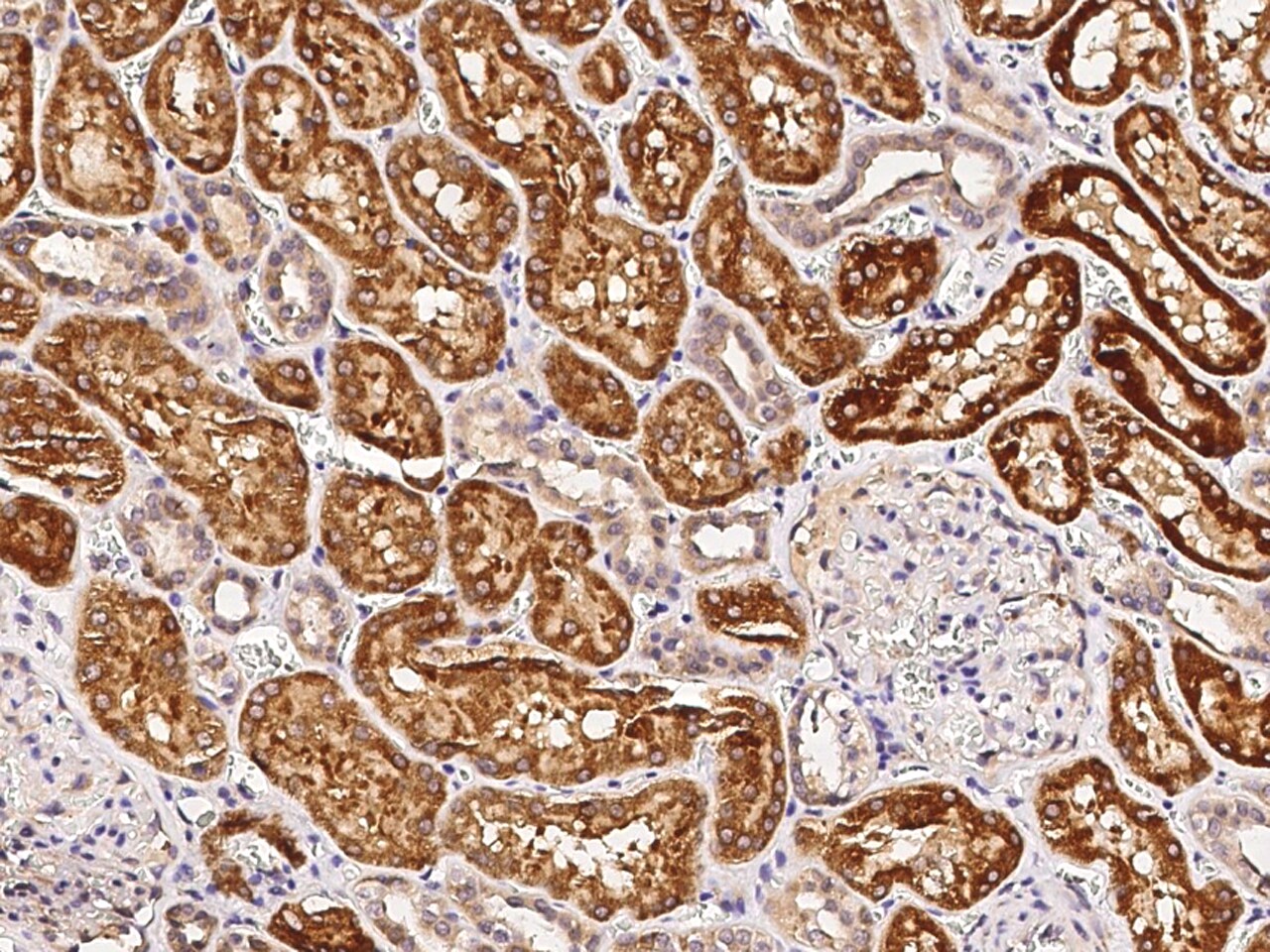 CD39L4/ENTPD5 Antibody (064) - Azide and BSA Free