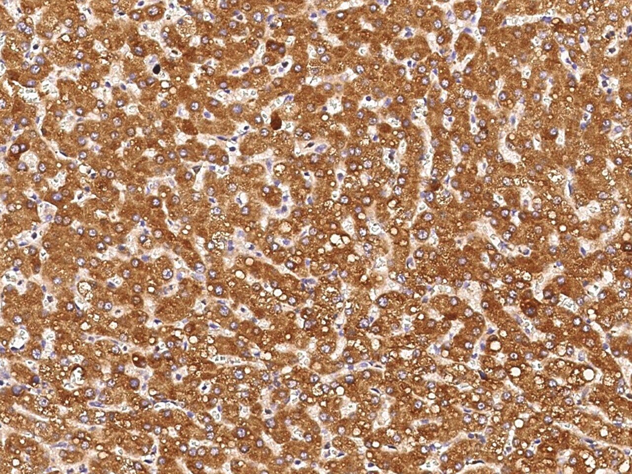 CD39L4/ENTPD5 Antibody (064) - Azide and BSA Free