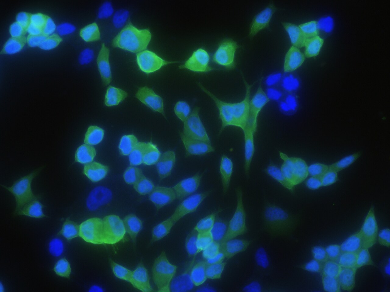 CRABP2 Antibody (004) - Azide and BSA Free