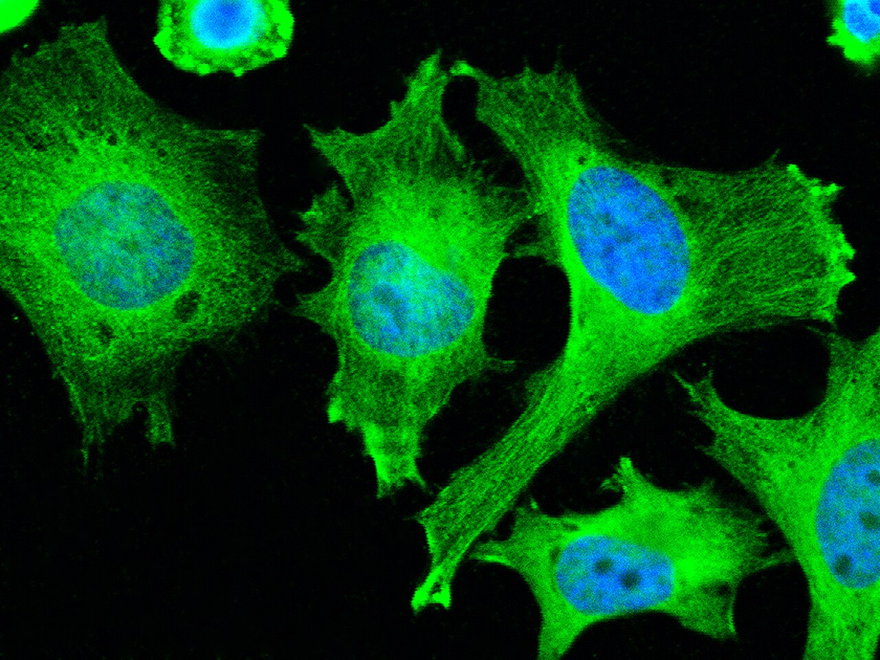 Adenylosuccinate Lyase Antibody (007) - Azide and BSA Free