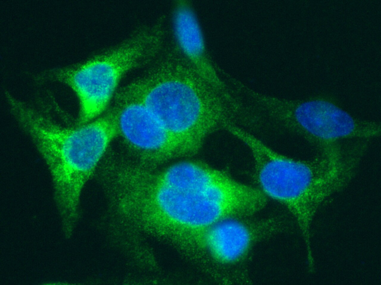 Serum Amyloid A4 Antibody (001) - Azide and BSA Free