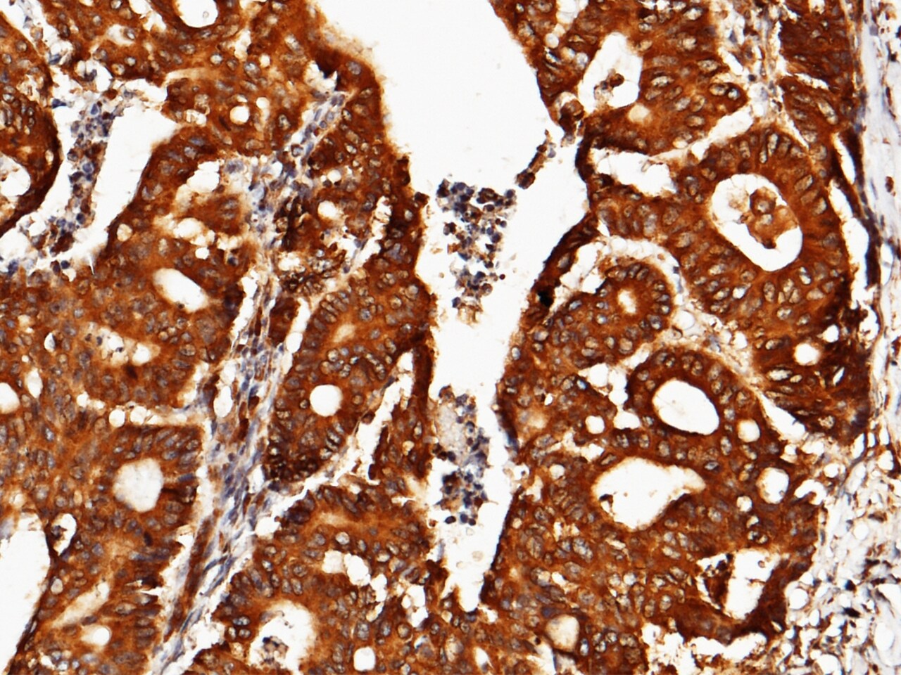 ORP150/HSP12A Antibody (201) - Azide and BSA Free