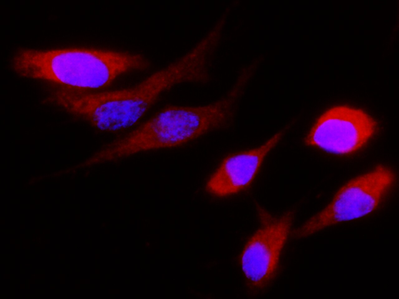 Cystatin S Antibody (006) - Azide and BSA Free