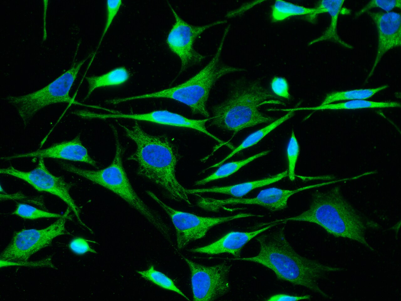 ALDH7A1 Antibody (101) - Azide and BSA Free