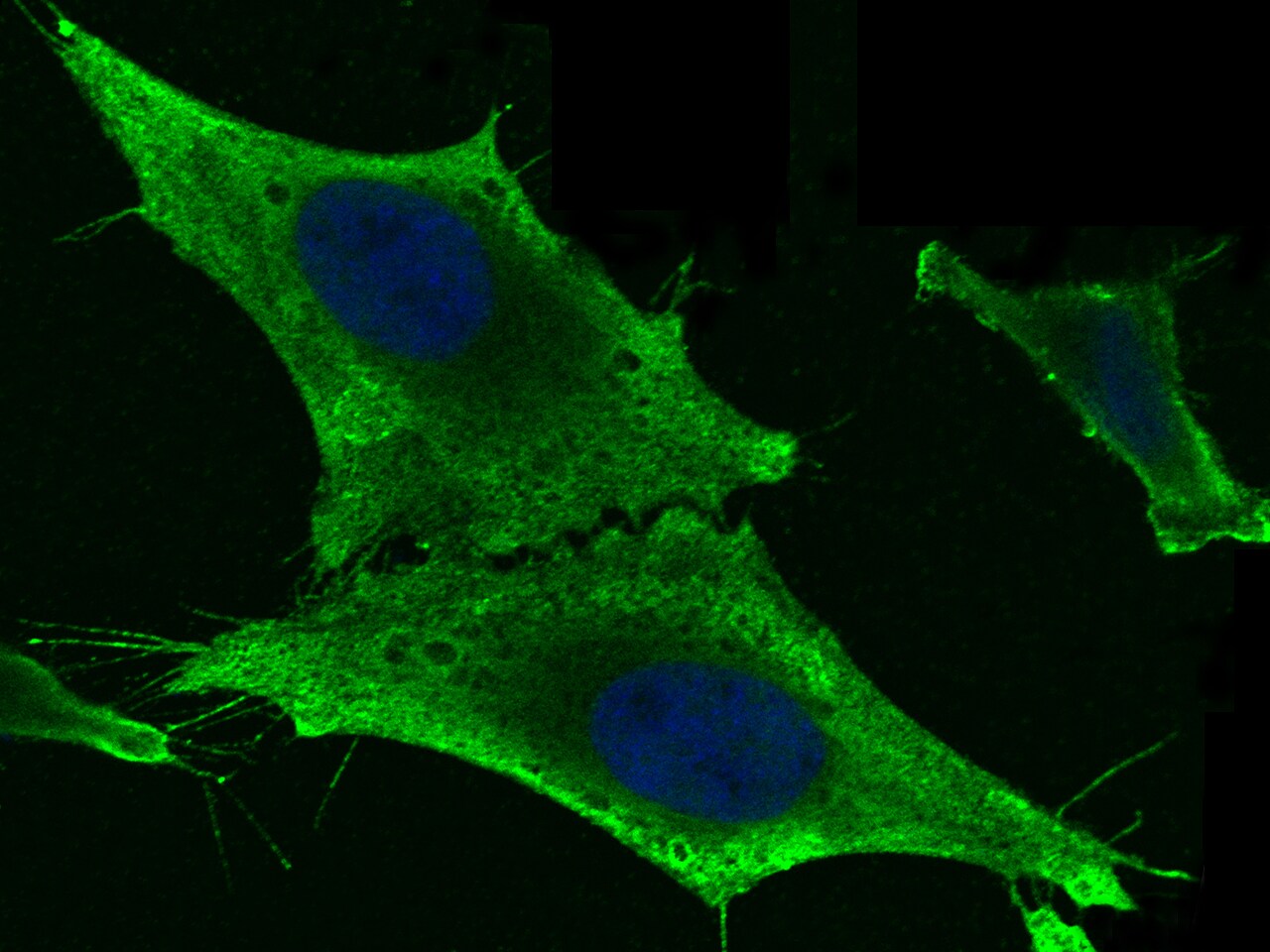 GSTM2 Antibody (006) - Azide and BSA Free