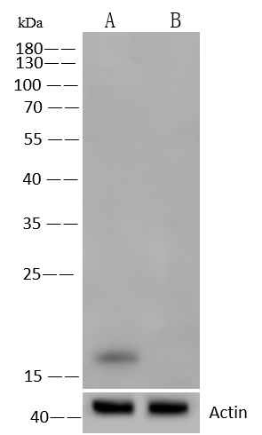 alpha-Synuclein Antibody (017)