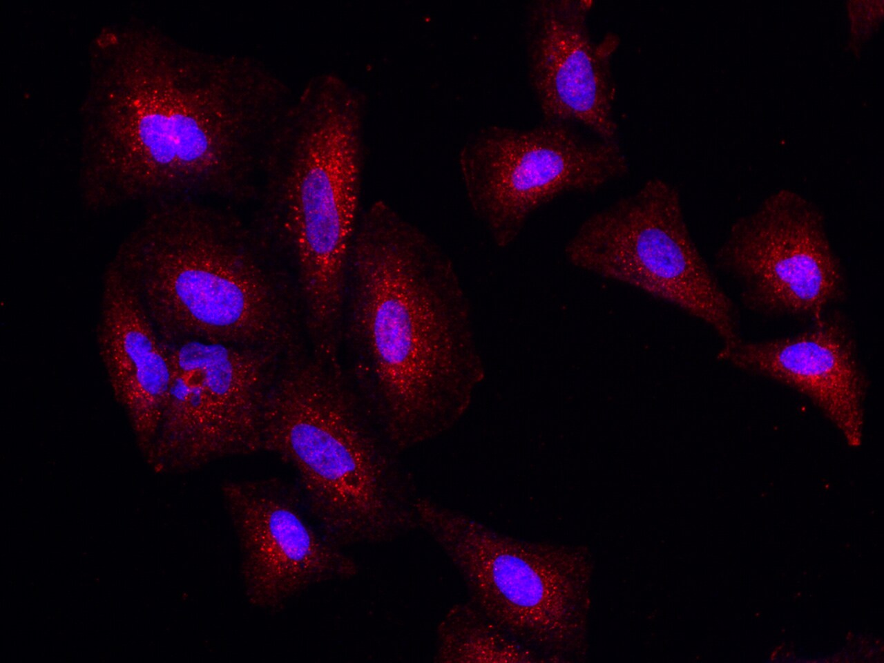 Phosphoserine phosphatase Antibody (001) - Azide and BSA Free