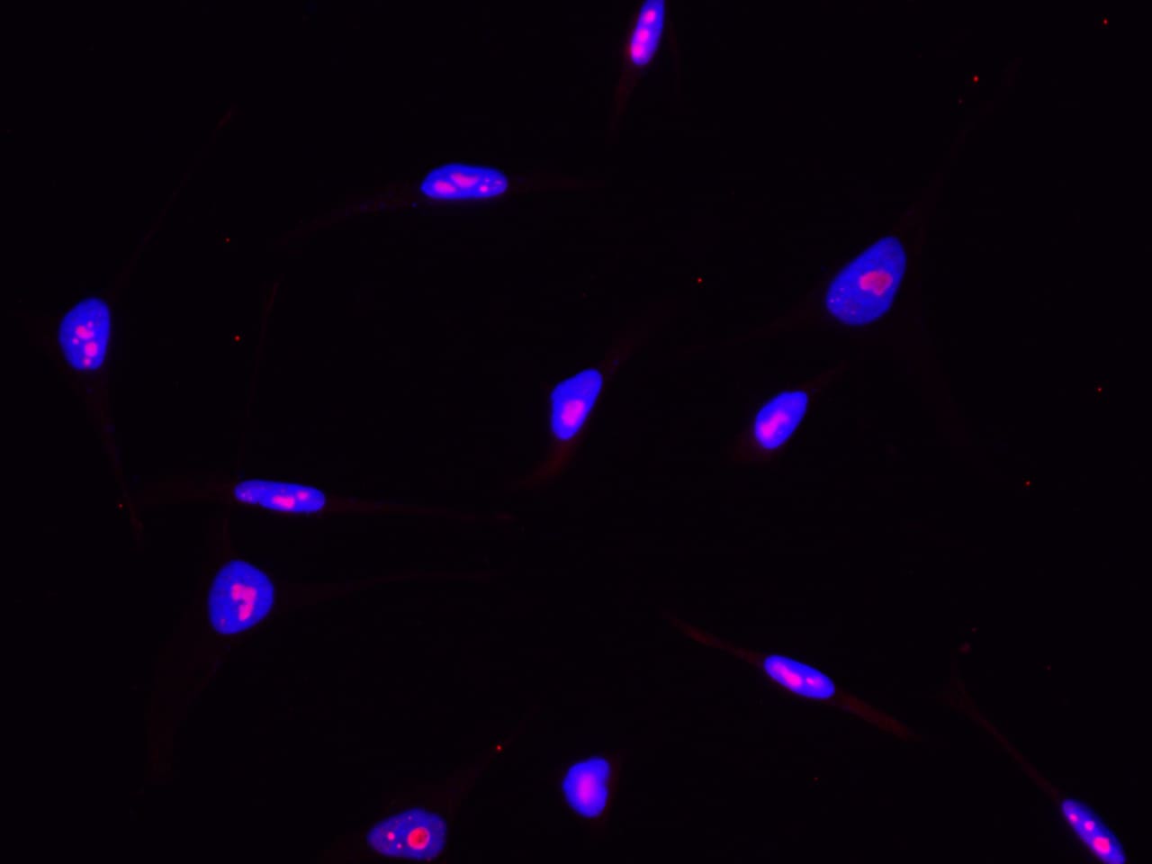 ABHD14B Antibody (002) - Azide and BSA Free