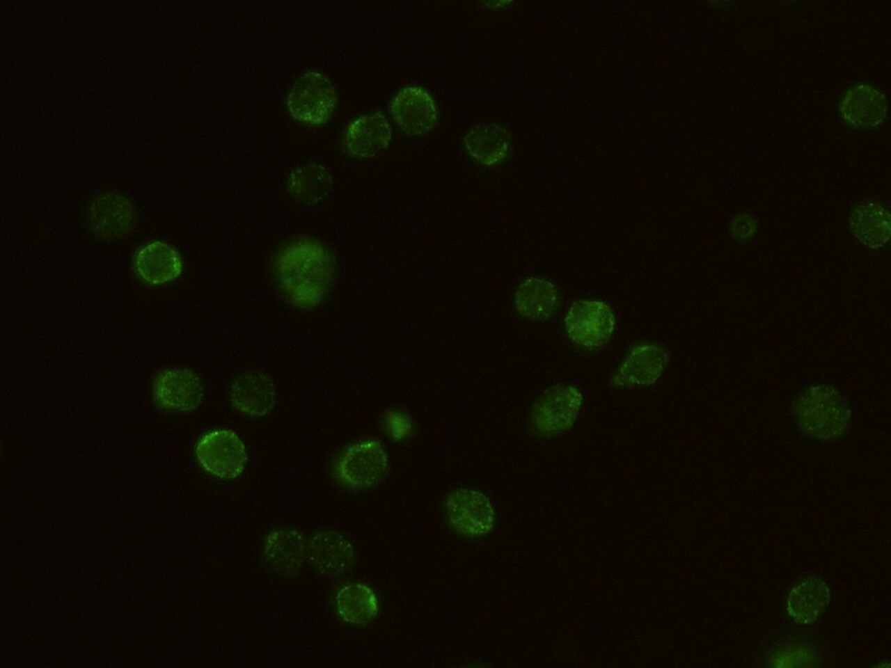 Common gamma Chain/IL-2 R gamma Antibody (011) - Azide and BSA Free