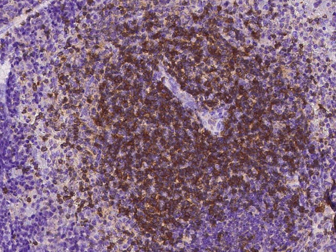 CD27/TNFRSF7 Antibody (618) - Azide and BSA Free