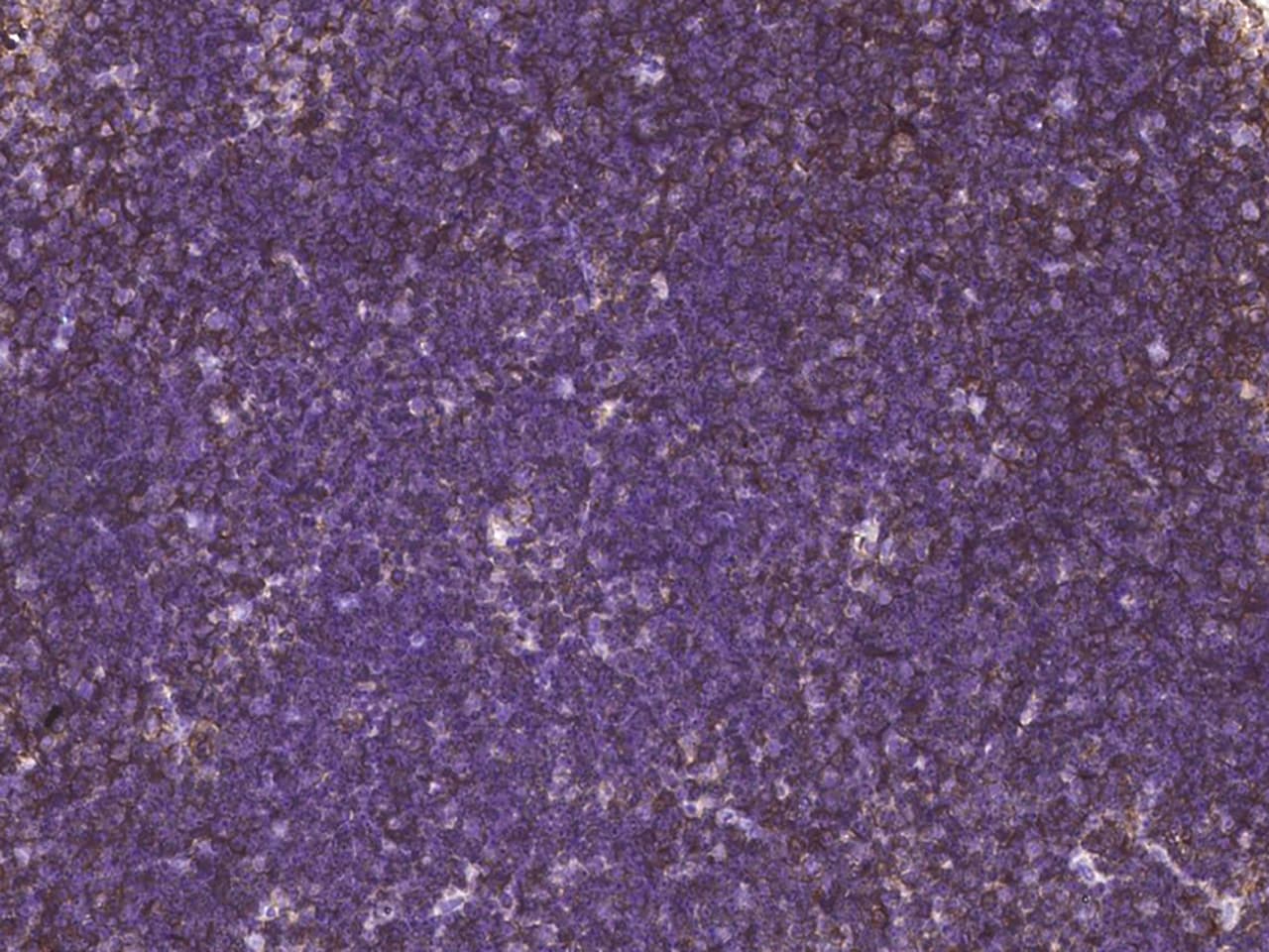 CD27/TNFRSF7 Antibody (618) - Azide and BSA Free