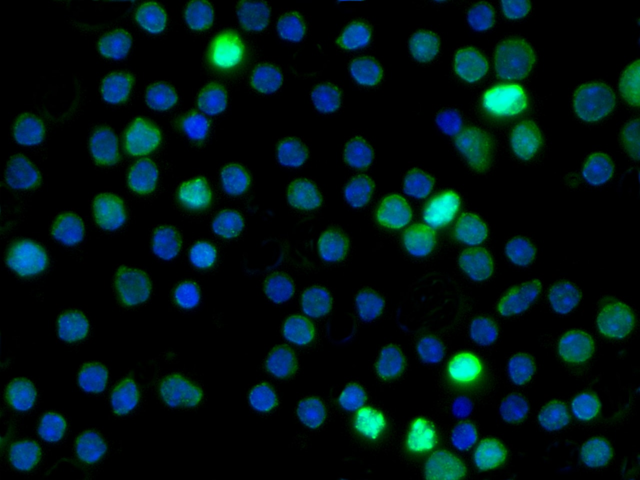 RBP4/Retinol-Binding Protein 4 Antibody (008) - Azide and BSA Free