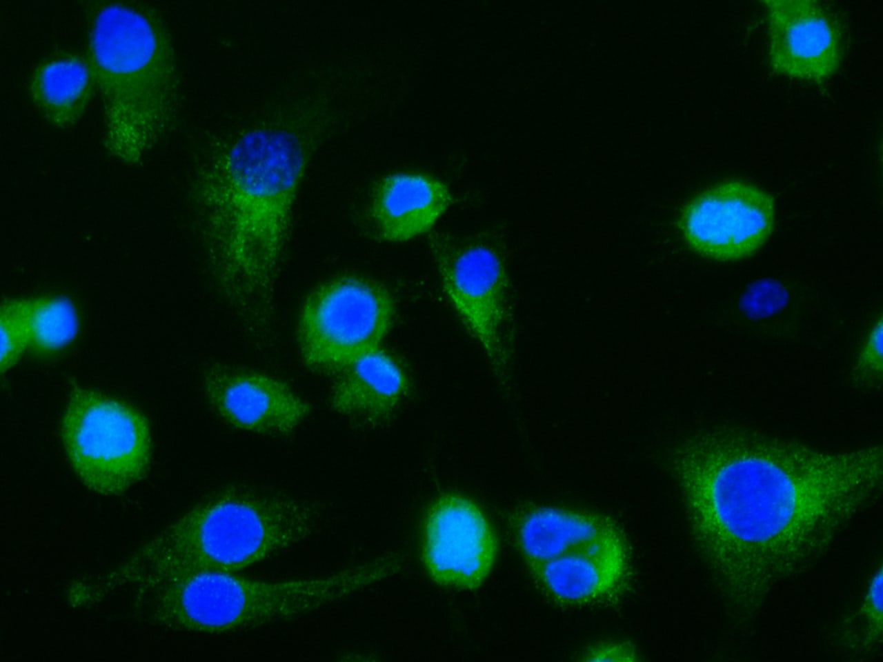Dectin-1/CLEC7A Antibody (010) - Azide and BSA Free