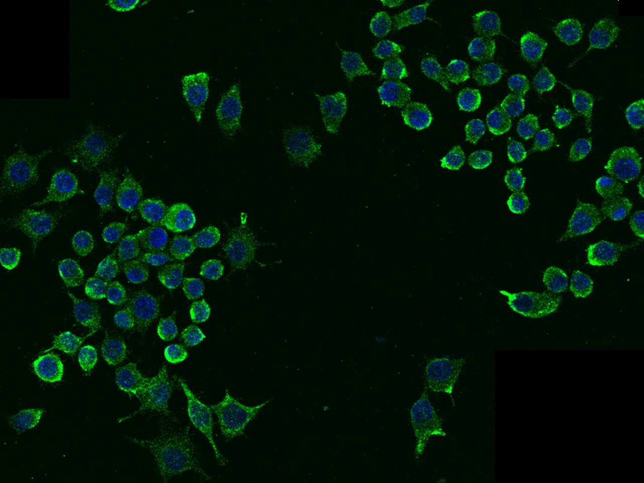 LDLR Antibody (101) - Azide and BSA Free
