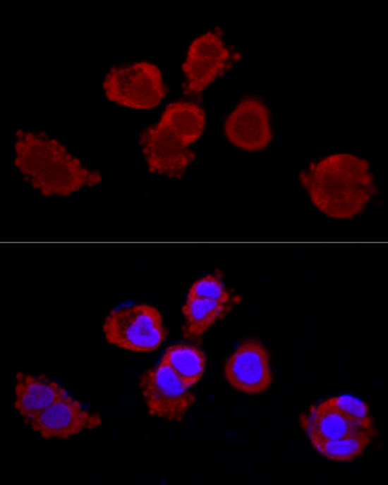 Cytokeratin 3 Antibody - BSA Free
