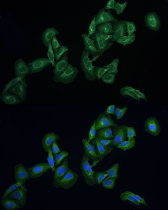 AGTRAP Antibody - Azide and BSA Free