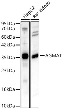 AGMAT Antibody - Azide and BSA Free