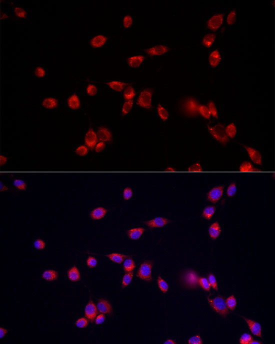 ATP13A2 Antibody - Azide and BSA Free