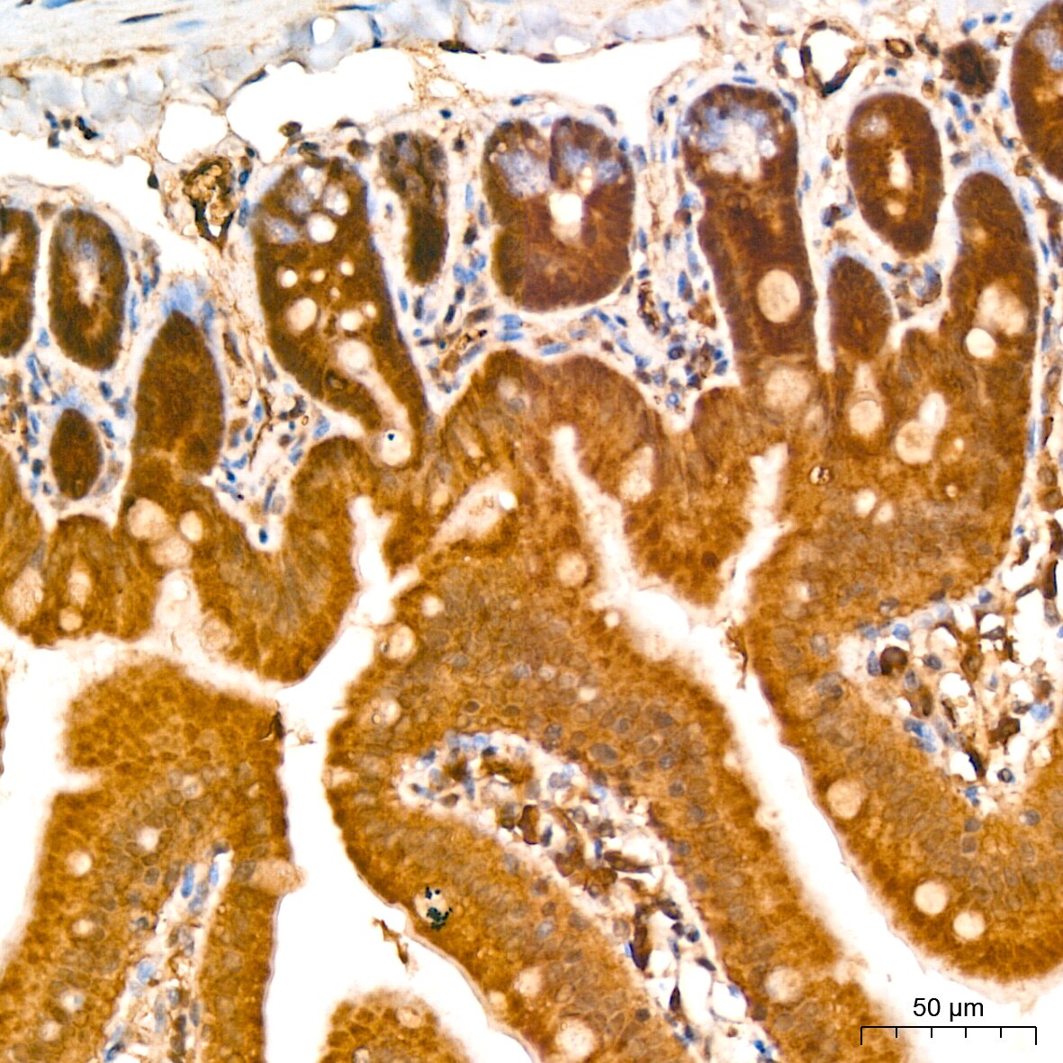 CNBP Antibody - Azide and BSA Free