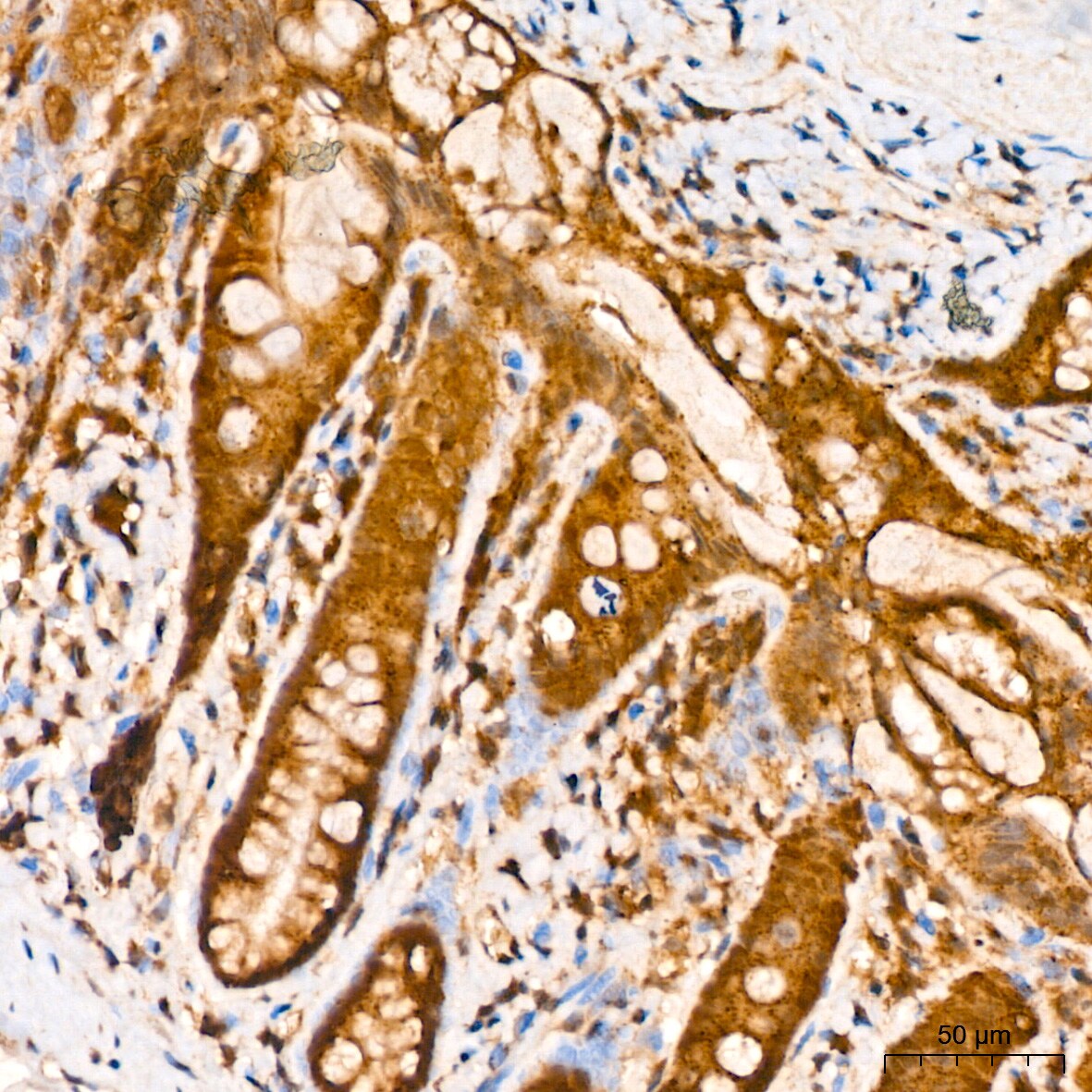 CNBP Antibody - Azide and BSA Free