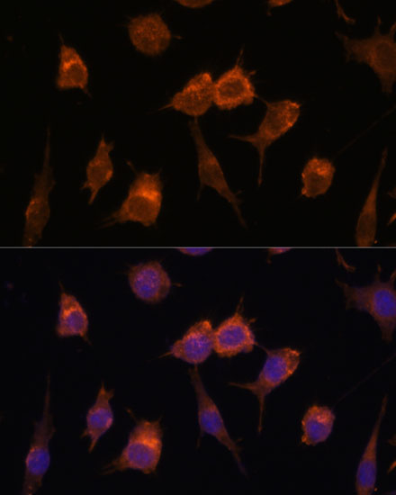 Advillin Antibody - Azide and BSA Free