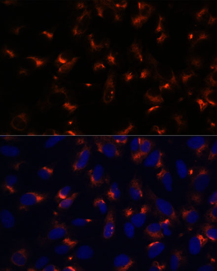 CCDC47 Antibody - Azide and BSA Free