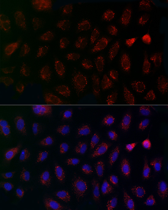 CCDC109A Antibody - Azide and BSA Free