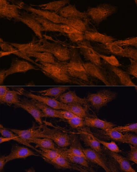 COMMD5 Antibody - Azide and BSA Free