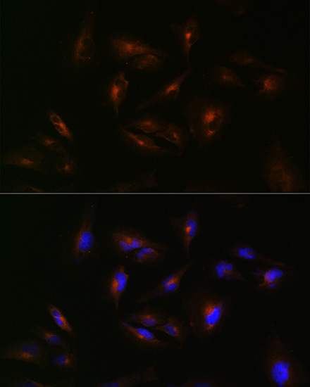 ABCA2 Antibody - Azide and BSA Free