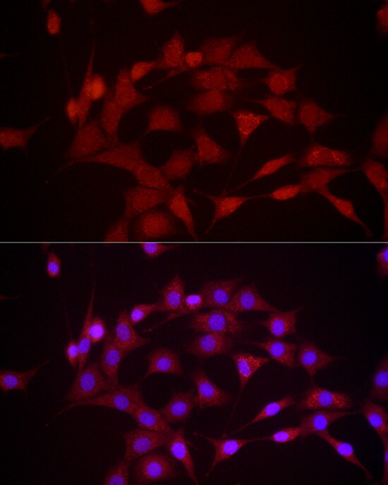 DUSP8 Antibody - Azide and BSA Free