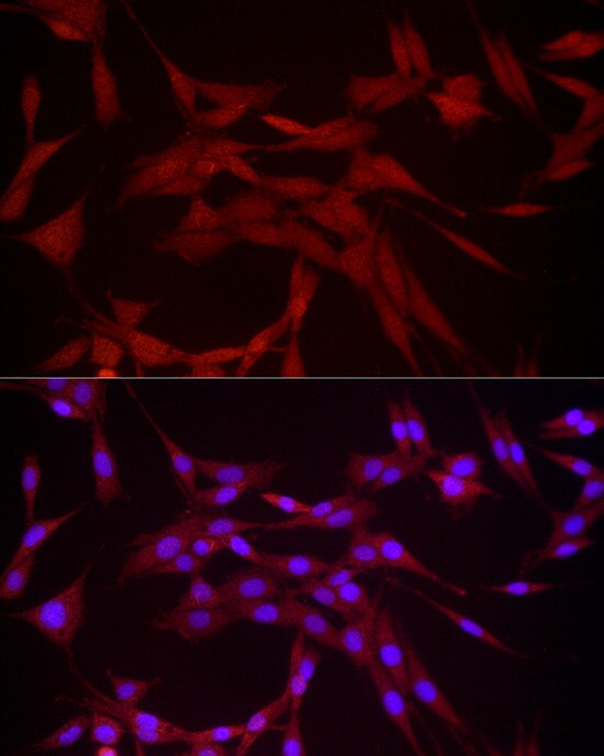 DUSP8 Antibody - Azide and BSA Free