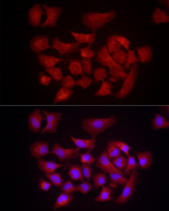 DUSP8 Antibody - Azide and BSA Free