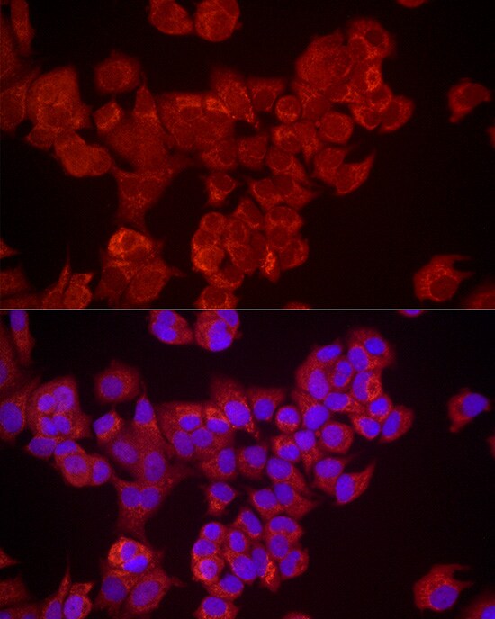 DUSP8 Antibody - Azide and BSA Free