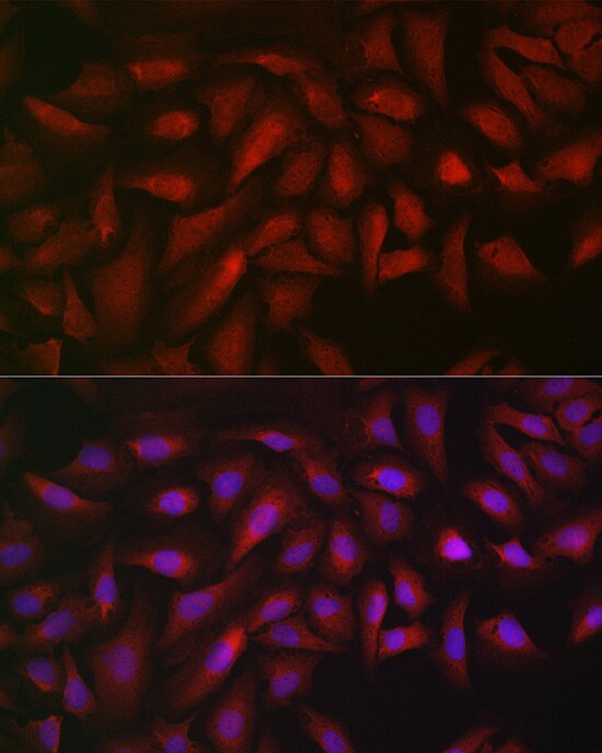 ATF5 Antibody - Azide and BSA Free