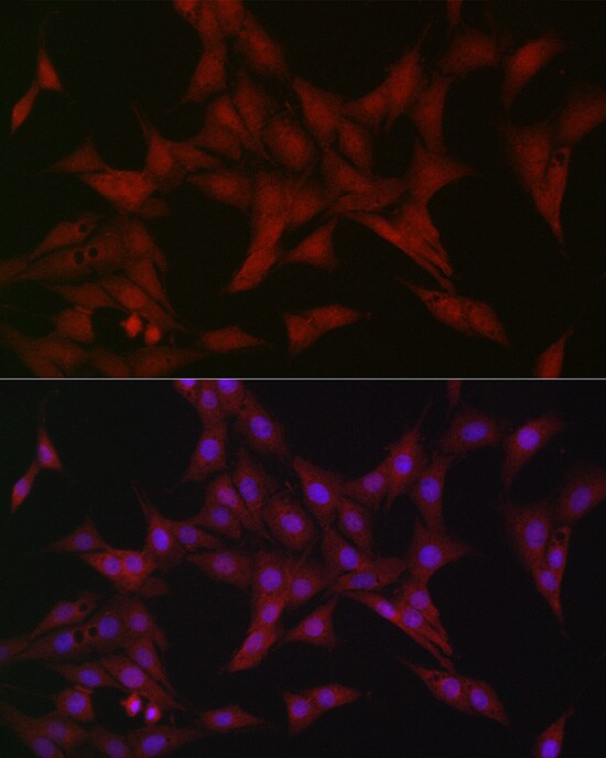 ATF5 Antibody - Azide and BSA Free