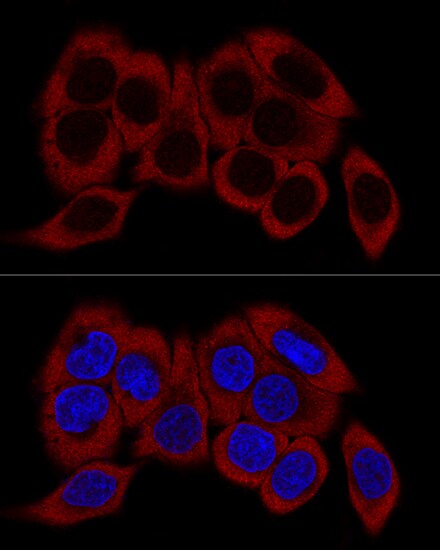60S ribosomal protein L23 Antibody - BSA Free