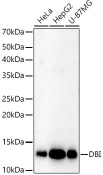ACBP Antibody - BSA Free
