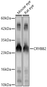 CRYBB2 Antibody - BSA Free