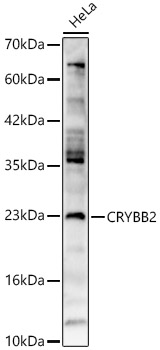 CRYBB2 Antibody - BSA Free