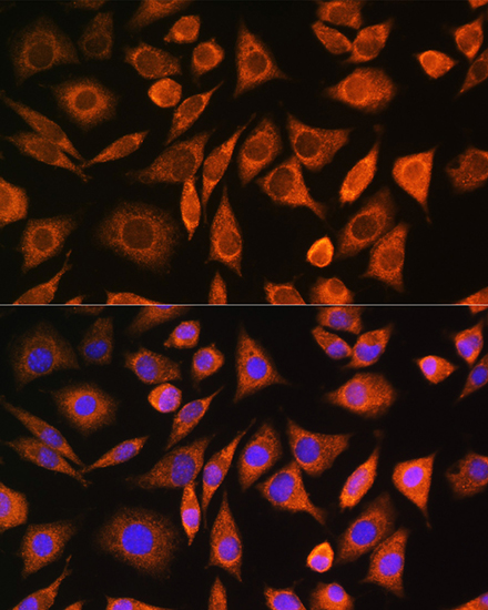 CNOT1 Antibody - Azide and BSA Free