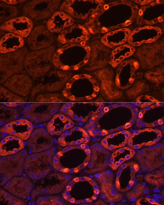 ATP6V1B1 Antibody - BSA Free