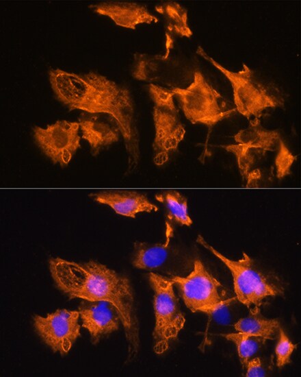 ARF4 Antibody - Azide and BSA Free