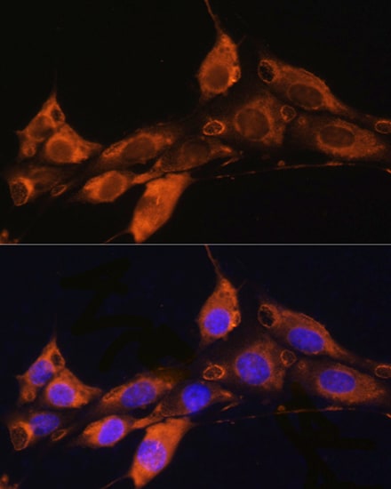 ARF4 Antibody - Azide and BSA Free