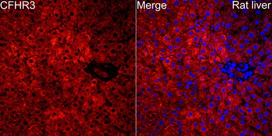 Complement Factor H-related 3/CFHR3 Antibody - BSA Free