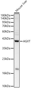 AGXT Antibody - BSA Free